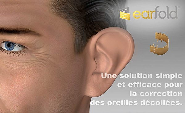 Earfold