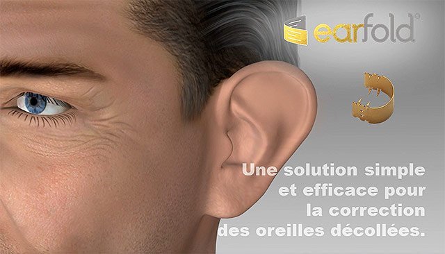 Earfold